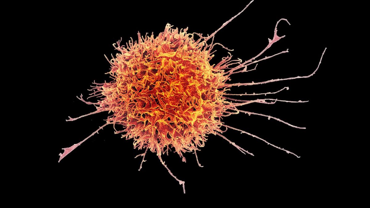 Un nuevo estudio revela cómo las células NK pueden regular la actividad de las células T, lo que podría interferir en las inmunoterapias contra el cáncer
