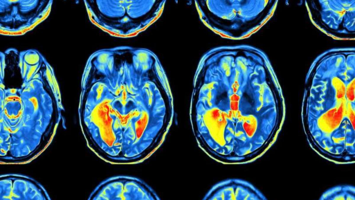 La investigadora española María Llorens-Martín es galardonada por sus contribuciones en el campo de la neurociencia