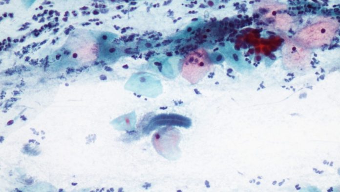 Citología de cuello uterino