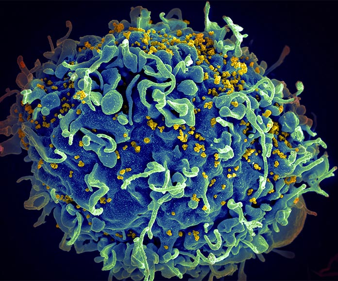 Virus VIH microbiología