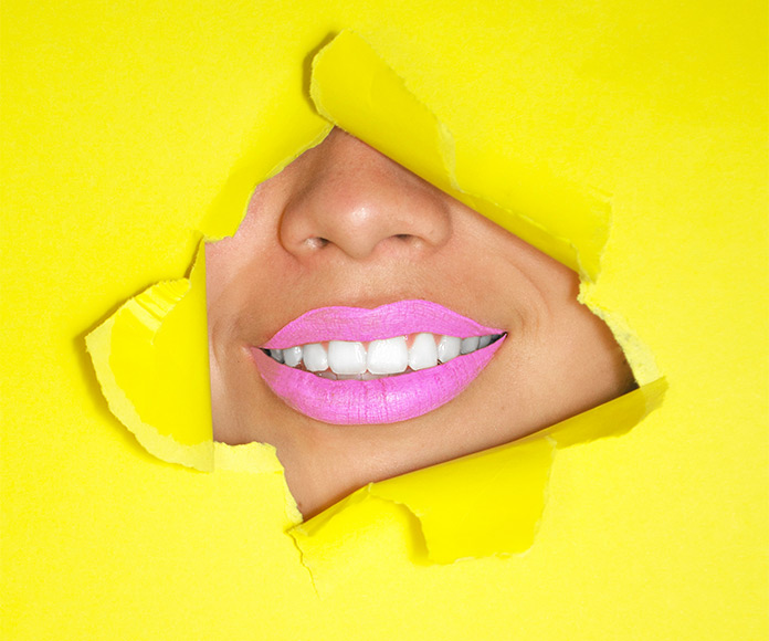 ¿Cómo blanquear los dientes? Boca de mujer apareciendo a través de un papel roto amarillo.