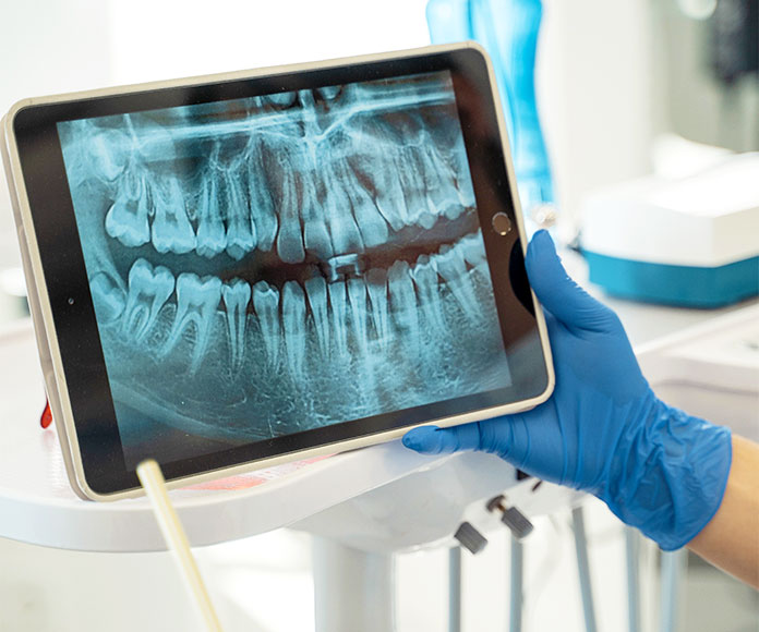 Dentista sosteniendo radiografía de una boca