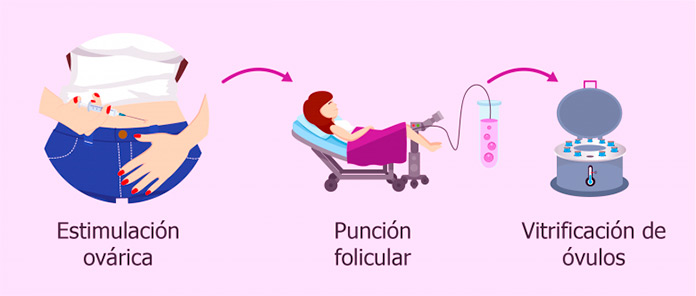 En qué consiste la congelación de óvulos