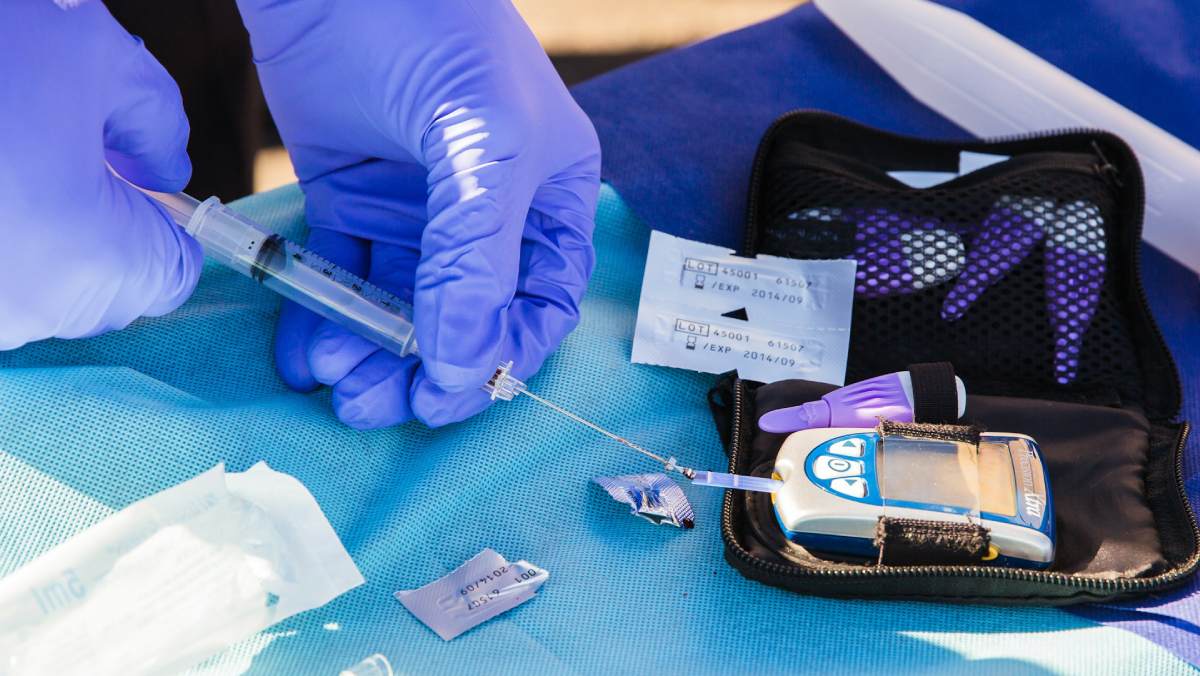 El Hospital Universitario Karolinska Huddinge revela por qué la diabetes tipo 2 afecta más a los hombres