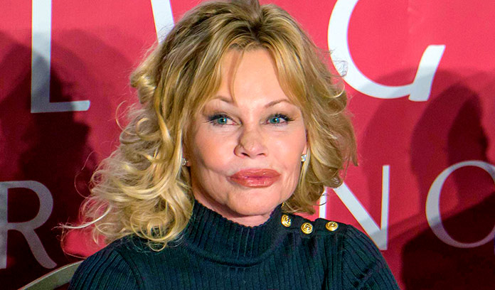 Melanie Griffith después