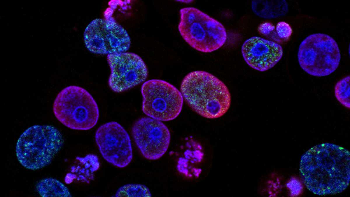 Investigadores descubren nuevo vínculo genético en múltiples tipos de tumores sólidos