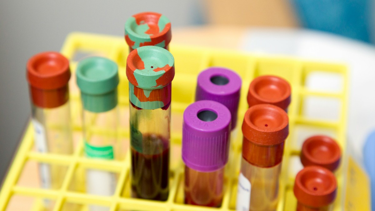 Investigadores del Reino Unido descubren un grupo de proteínas en la sangre que podrían predecir el cáncer con siete años de anticipación