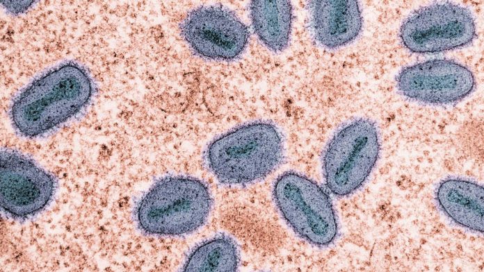 Microbios