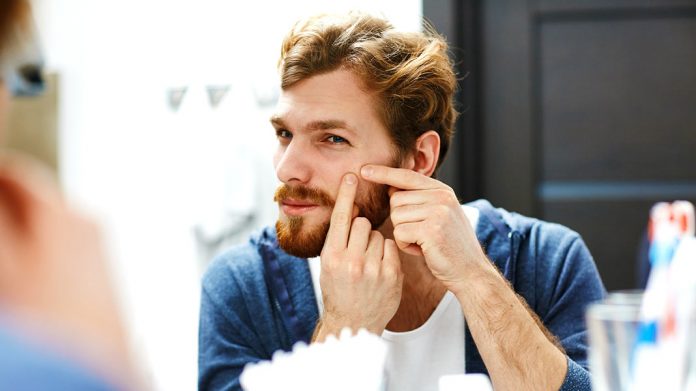 Métodos tradicionales que usa la cosmética para el tratamiento del acné